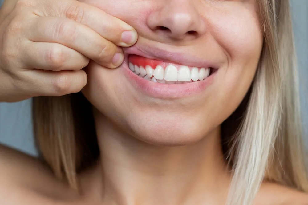 how does gum inflammation go away